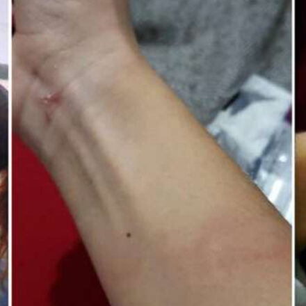 Namorada de DJ e produtor brasileiro denuncia agressão