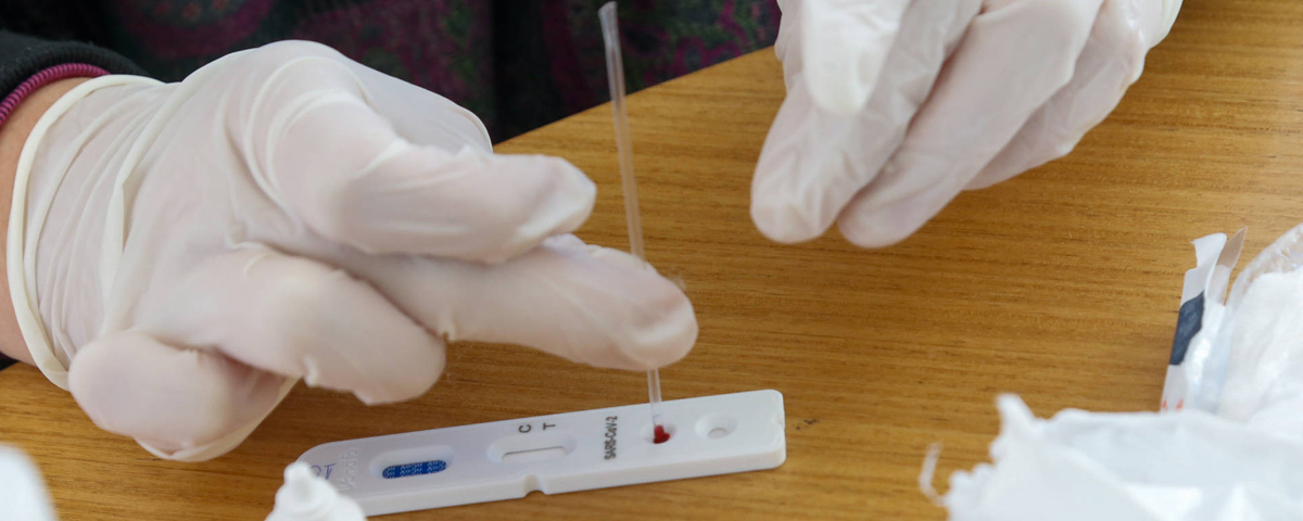 Reino Unido fará testes rápidos de Covid-19 em eventos